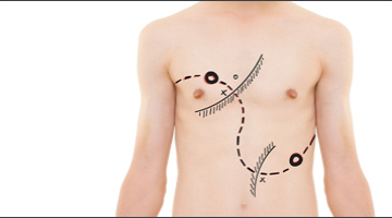 AnimaCaptus - Troades